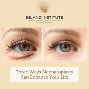 Gilbert Blepharoplasty 300x300