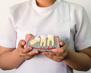 HowAreWisdomTeeth 300x240
