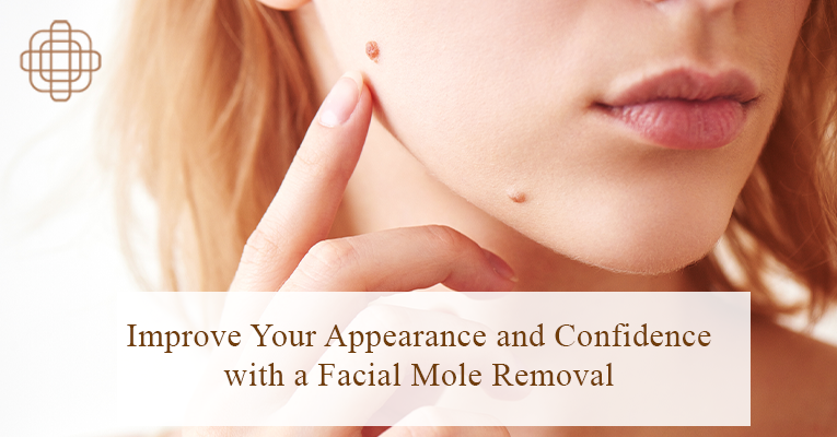 MoleRemoval