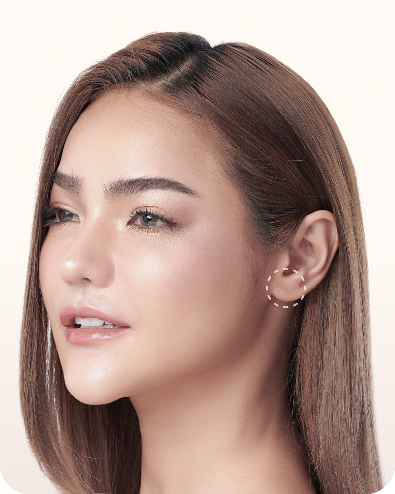 Inland earlobe repair banner mobile
