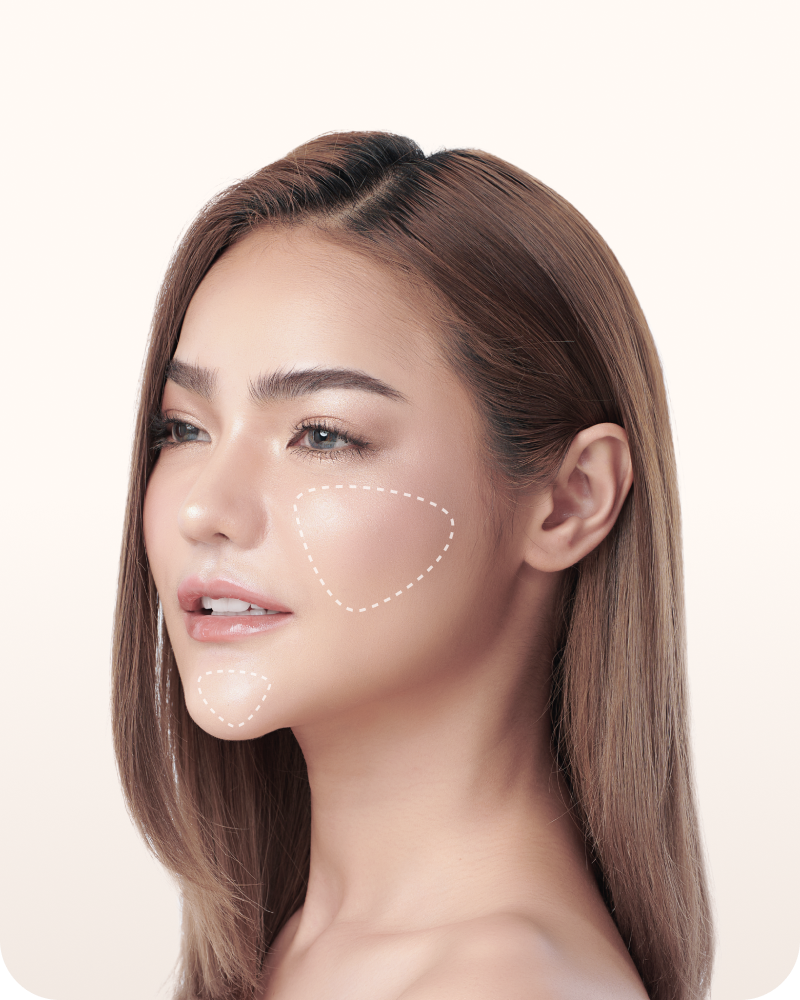 Inland facial implants banner mobile